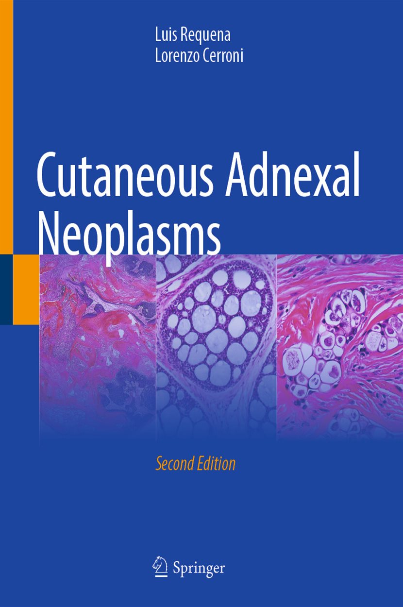 Cutaneous Adnexal Neoplasms